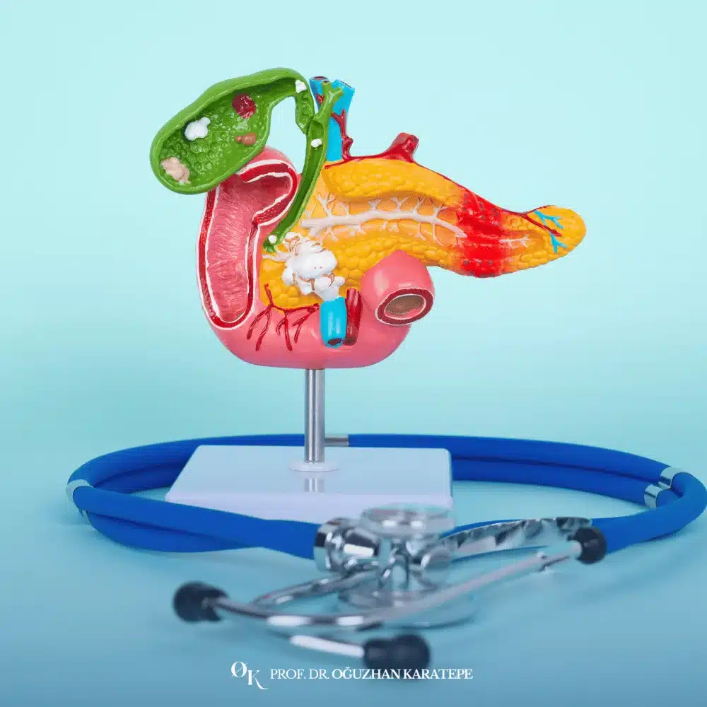pankreas ameliyatı yapan doktor kanser tedavisi