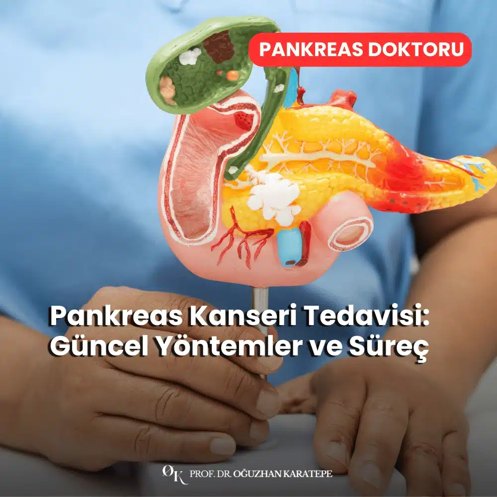 Pankreas Kanseri Tedavisi