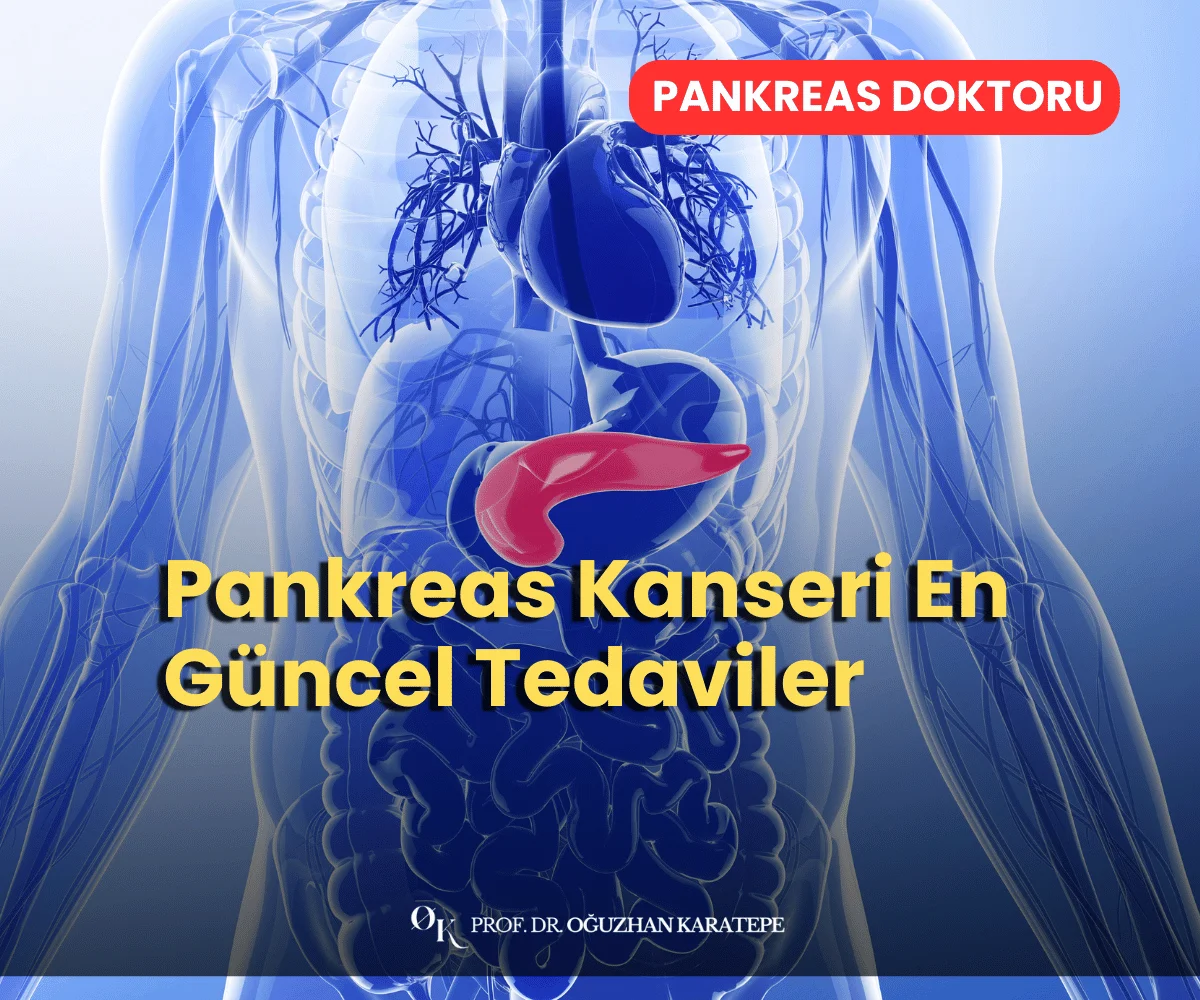 Pankreas Kanseri En Güncel Tedaviler Neler