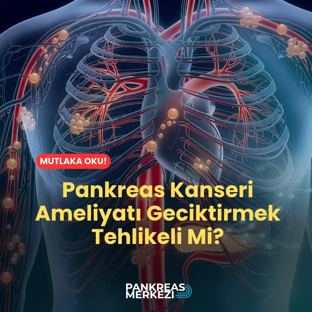 Pankreas Kanseri Ameliyatı Geciktirmek Tehlikeli Mi