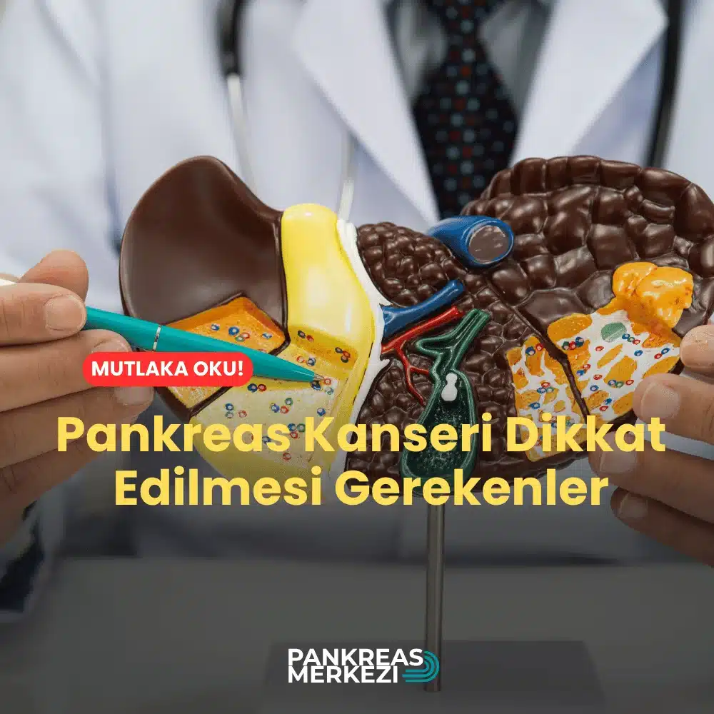 Pankreas Kanseri Dikkat Edilmesi Gerekenler