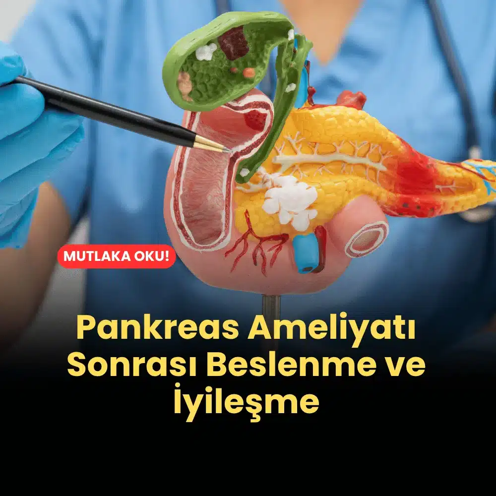 Pankreas Ameliyatı Sonrası Beslenme ve İyileşme Süreci