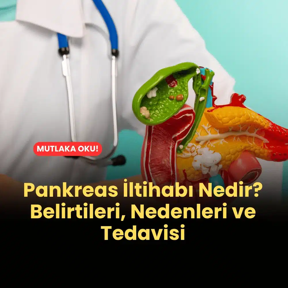 Pankreas İltihabı Nedir? Belirtileri, Nedenleri ve Tedavisi Nedir